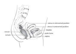 Uterus in retroverted and anteverted positions vector illustration © SandraTavares.com